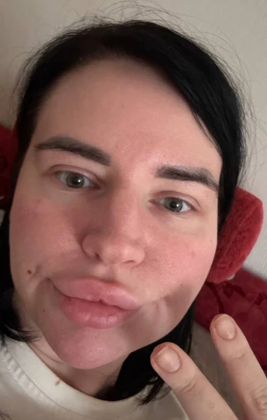 После нападения: Саша Черно нашла силы жить дальше и встретила новую л