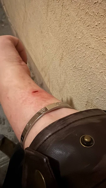 Сашу Черно избили